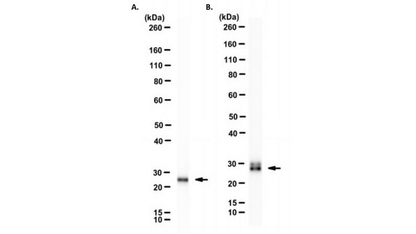 Anti-Smith Antigen Antibody, clone Y12 | MABF2793-25UL